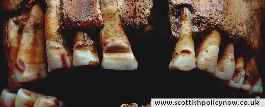 Uncover the Mysterious Practice of Vikings Filing Grooves Into Their Teeth for Identification